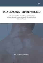 Tata Laksana Terkini Vitiligo